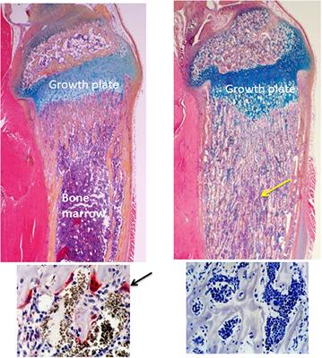 Bone Remodeling and the Role of TRAF3 in Osteoclastic Bone Resorption